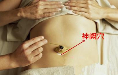 腹泻艾灸哪里?拉肚子艾灸什么部位