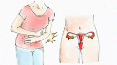腺性膀胱炎宫颈息肉怎么灸?艾灸有作用吗?