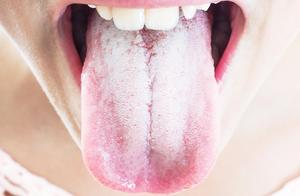 舌麻