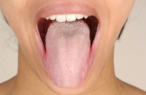 舌痛