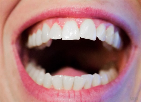 牙龈出血艾灸穴位及调理方法